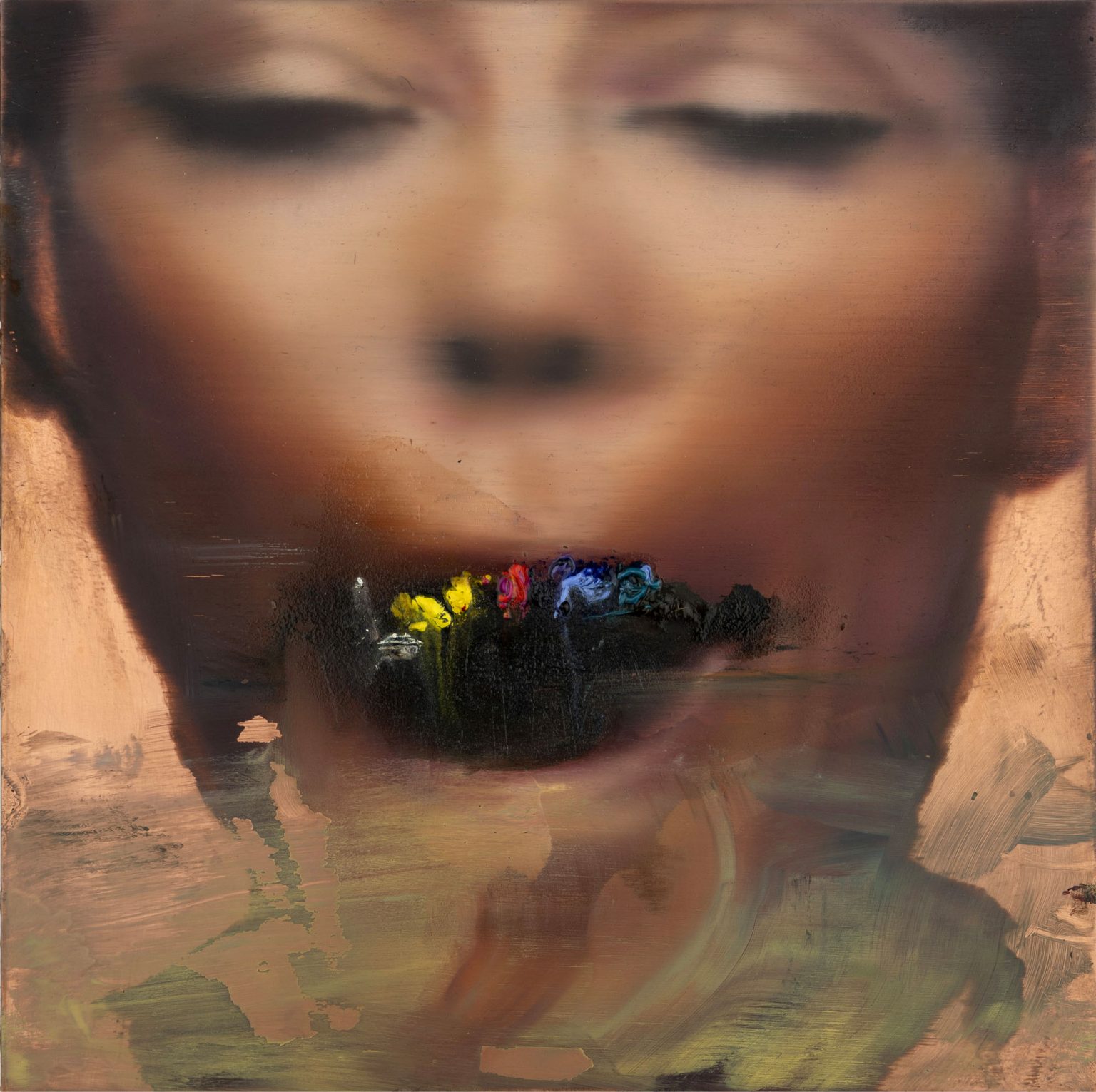 Image gallery Tooth discoloration by Els Nouwen