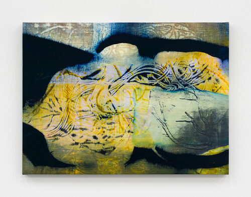 View featured artwork Chest X-Ray (Posterior) by Alex Carver