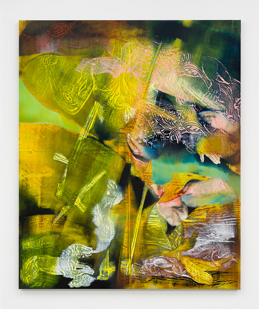 The Fragile Masculine Ideal (After Wound Man) by Alex Carver