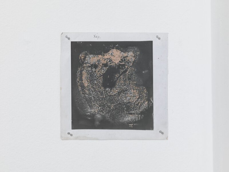 Syndromes of Synthetic Never