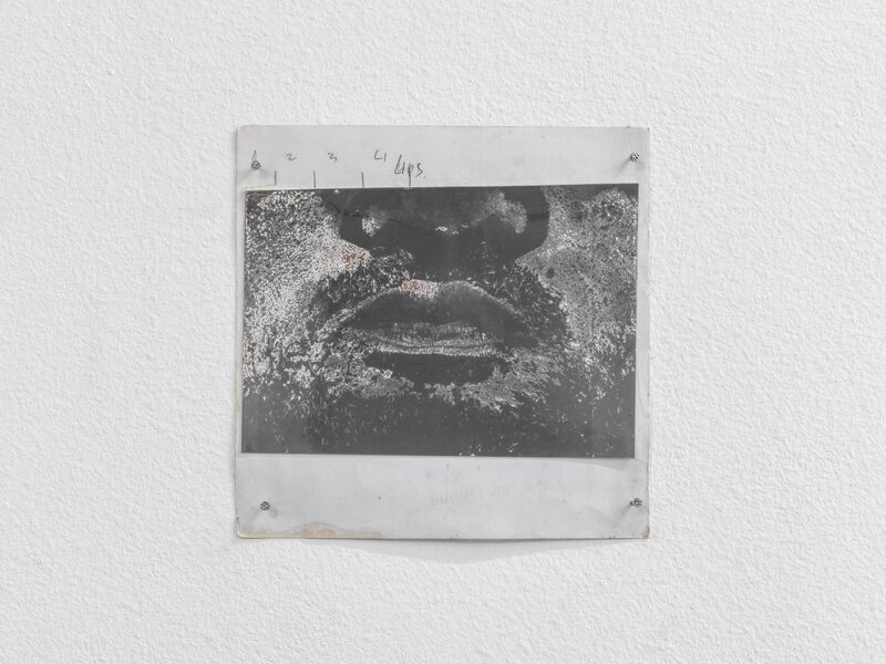 Syndromes of Synthetic Never